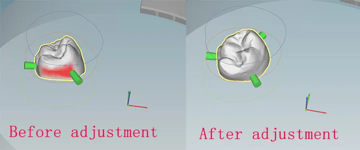 Reduce deep undercuts Reduce deep undercuts